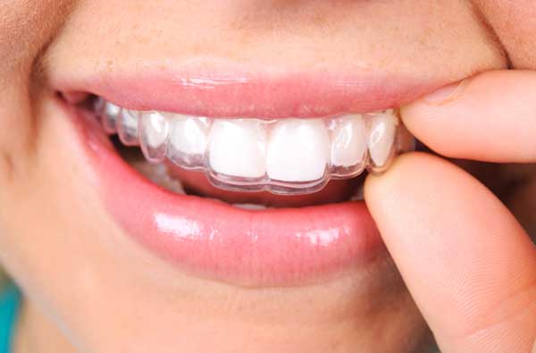 Woman using Invisalign clear aligner at Cascade Dental in Medford, OR